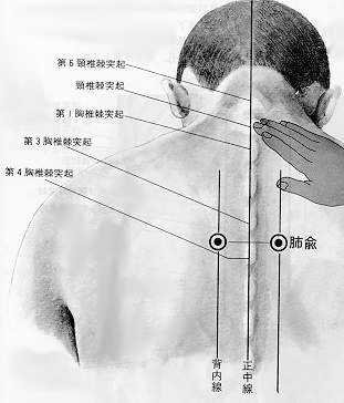 Assentiment du poumon, 肺俞 fèishù, est le treizième point du méridien de la vessie.