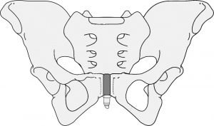 Anatomie du bassin, la symphyse pubienne