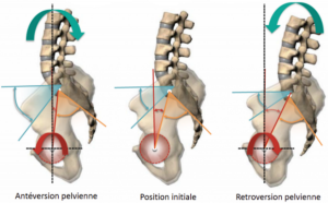 Illustration de l'antéversion et de la rétroversion pelvienne