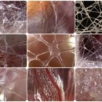 Fascias au microscope – photographies Dr Jean Claude Guimberteau