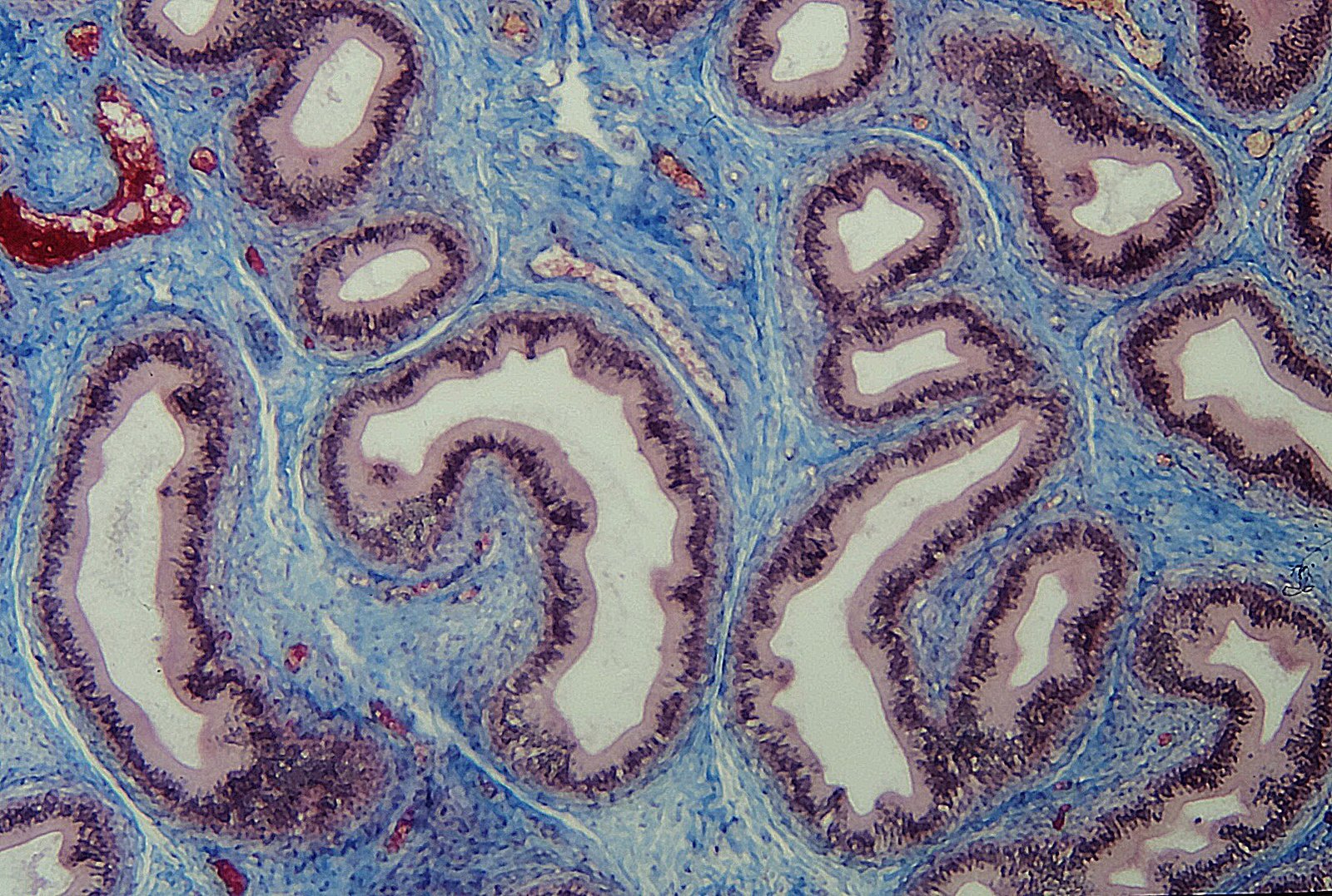 Section de l'épididyme. Le tissu conjonctif (en bleu) soutenant l'épithélium (en violet).